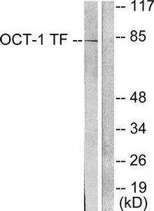 WB using the antibody against H3K27me1 diluted 1:1,000 in TBS-Tween containing 5% skimmed milk. The position of the protein of interest is indicated on the right; the marker (in kDa) is shown on the left.