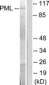 WB using the antibody against H3K9ac diluted 1:1,000 in TBS-Tween containing 5% skimmed milk. The position of the protein of interest is indicated on the right; the marker (in kDa) is shown on the left.