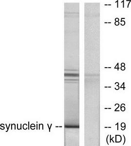 Western blot analysis of extracts from HT29 cells, using Synuclein ? Antibody (#TA313036).The lane on the right is treated with the synthesized peptide.