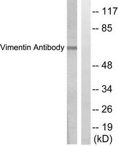 Western blot analysis of extracts from HepG2 cells, treated with Adriamycin (0.5uM, 5hours), using Vimentin antibody.The lane on the right is treated with the synthesized peptide.