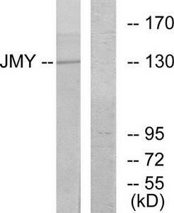 Western blot analysis of extracts from COLO cells, using JMY antibody.The lane on the right is treated with the synthesized peptide.