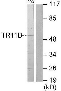 Western blot analysis of extracts from 293 cells, using TR11B antibody.The lane on the right is treated with the synthesized peptide.