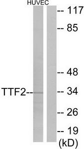 Western blot analysis of extracts from HUVEC cells, using TTF2 antibody.The lane on the right is treated with the synthesized peptide.