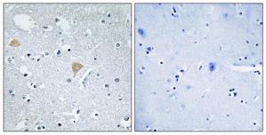 Immunohistochemistry analysis of paraffin-embedded human brain tissue using CTRO antibody.The picture on the right is treated with the synthesized peptide.