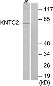 Western blot analysis of extracts from Jurkat cells, using KNTC2 antibody.The lane on the right is treated with the synthesized peptide.