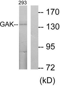 Western blot analysis of extracts from 293 cells, using GAK antibody.The lane on the right is treated with the synthesized peptide.