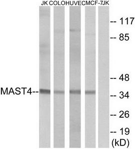 Western blot analysis of extracts from Jurkat cells, COLO cells, HUVEC cells and MCF-7 cells, using MAST4 antibody.The lane on the right is treated with the synthesized peptide.