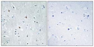Immunohistochemistry analysis of paraffin-embedded human brain tissue, using SOX12 antibody.The picture on the right is treated with the synthesized peptide.