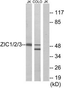 Western blot analysis of extracts from Jurkat cells and COLO cells, using ZIC1/2/3 antibody.The lane on the right is treated with the synthesized peptide.