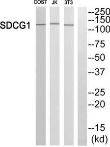 Western blot analysis of extracts from HUVEC cells, using SDCG1 antibody.The lane on the right is treated with the synthesized peptide.