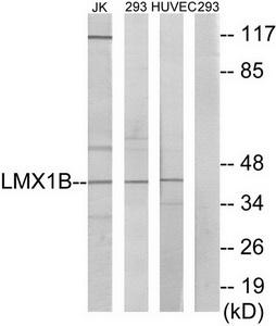 Western blot analysis of extracts from Jurkat cells, 293 cells and HUVEC cells, using LMX1B antibody.The lane on the right is treated with the synthesized peptide.