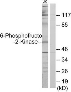WB using the antibody against H3K4me3 diluted 1:1,000 in TBS-Tween containing 5% skimmed milk. The position of the protein of interest is indicated on the right; the marker (in kDa) is shown on the left.