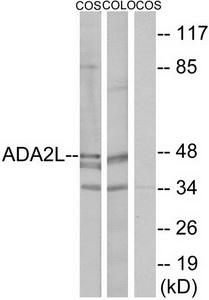 Western blot analysis of extracts from COS-7 cells and COLO205 cells, using ADA2L antibody.The lane on the right is treated with the synthesized peptide.