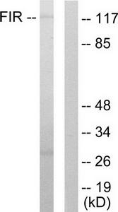 Western blot analysis of extracts from HuvEc cells, using FIR antibody.The lane on the right is treated with the synthesized peptide.