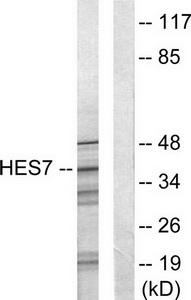 Western blot analysis of extracts from NIH-3T3 cells, using HES7 antibody.The lane on the right is treated with the synthesized peptide.