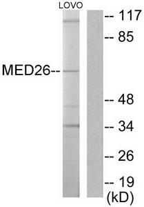 Western blot analysis of extracts from LOVO cells, using MED26 antibody.The lane on the right is treated with the synthesized peptide.