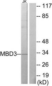 Western blot analysis of extracts from Jurkat cells, using MBD3 antibody.The lane on the right is treated with the synthesized peptide.