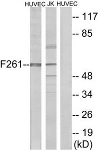 WB was performed on whole cell (25ug, lane 1) and histone extracts (15ug, lane 2 ) from HeLa cells, and on 1ug of recombinant histone H2A, H2B, H3 and H4 (lane 3, 4, 5 and 6, respectively) using the antibody against H2BK15ac. The antibody was diluted 1:500 in TBS-Tween containing 5% skimmed milk. The marker (in kDa) is shown on the left.