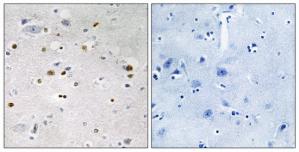 Immunohistochemistry analysis of paraffin-embedded human brain tissue, using ZNF7 antibody.The picture on the right is treated with the synthesized peptide.