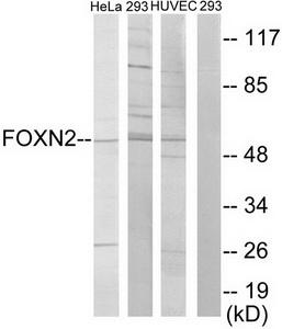 Western blot analysis of extracts from HT-2 cells and NIH-3T3 cells, using FOXN2 antibody.The lane on the right is treated with the synthesized peptide.