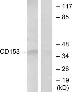 Western blot analysis of extracts from RAW264.7 cells, using CD153 antibody.The lane on the right is treated with the synthesized peptide.
