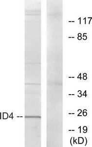 Western blot analysis of extracts from HepG2 cells, using ID4 antibody.The lane on the right is treated with the synthesized peptide.
