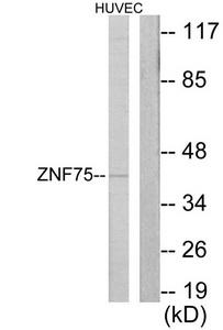 Western blot analysis of extracts from HUVEC cells, using ZNF75 antibody.The lane on the right is treated with the synthesized peptide.