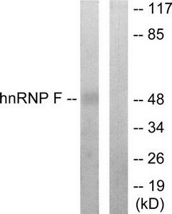 Western blot analysis of extracts from HepG2 cells, using hnRNP F antibody.The lane on the right is treated with the synthesized peptide.