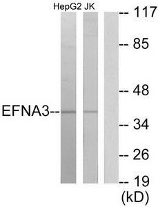 WB Suggested Anti-NOP5 Antibody Titration: 0.2-1ug/ml; ELISA Titer: 1:312500; Positive Control: MCF7 cell lysate
