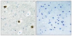 Immunohistochemistry analysis of paraffin-embedded human brain tissue, using TPD52 antibody.The picture on the right is treated with the synthesized peptide.