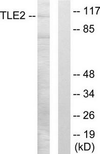 Western blot analysis of extracts from LOVO cells, using TLE2 antibody.The lane on the right is treated with the synthesized peptide.
