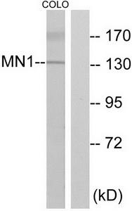 Western blot analysis of extracts from COLO cells, using MN1 antibody.The lane on the right is treated with the synthesized peptide.