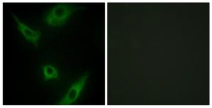 Immunofluorescence analysis of HeLa cells, using MAP3K1 antibody.The picture on the right is treated with the synthesized peptide.