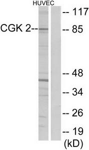 WB was performed on whole cell (25ug, lane 1) and histone extracts (15ug, lane 2 ) from HeLa cells, and on 1ug of recombinant histone H2A, H2B, H3 and H4 (lane 3, 4, 5 and 6, respectively) using the antibody against H4K5, 8, 12ac. The antibody was diluted 1:1,000 in TBS-Tween containing 5% skimmed milk. The position of the protein of interest is indicated on the right, the marker (in kDa) is shown on the left.