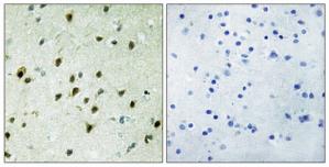 Immunohistochemistry analysis of paraffin-embedded human brain tissue, using MAD4 antibody.The picture on the right is treated with the synthesized peptide.