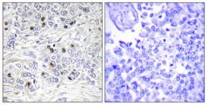 Western blot analysis on Jurkat and K562 cell lysate using KAPC A/B Antibody