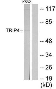 Western blot analysis on Jurkat cell lysate using DMPK Antibody