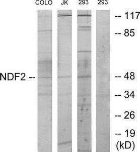 Western blot analysis of extracts from COLO cells, Jurkat cells and 293 cells, using NDF2 antibody.The lane on the right is treated with the synthesized peptide.