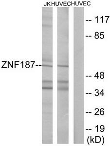 Western blot analysis of extracts from Jurkat cells and HUVEC cells, using ZNF187 antibody.The lane on the right is treated with the synthesized peptide.
