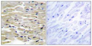 Immunohistochemistry analysis of paraffin-embedded human heart tissue, using TENS3 antibody.The picture on the right is treated with the synthesized peptide.