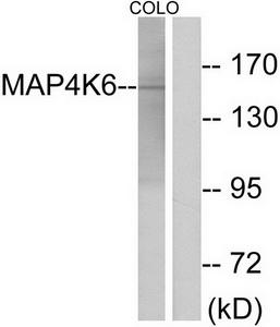 Western blot analysis of extracts from COLO cells, using MAP4K6 antibody.The lane on the right is treated with the synthesized peptide.
