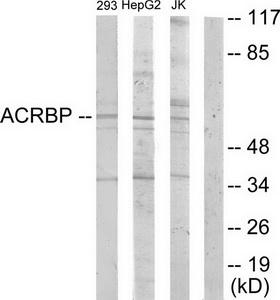 Western blot analysis of extracts from 293 cells, HepG2 cells and Jurkat cells, using ACRBP antibody.The lane on the right is treated with the synthesized peptide.