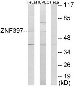 Western blot analysis of extracts from HeLa cells and HUVEC cells, using ZNF397 antibody.The lane on the right is treated with the synthesized peptide. Western blot analysis of extracts from HeLa cells and HUVEC cells, using ZNF397 antibody.The lane on the right is treated with the synthesized peptide.