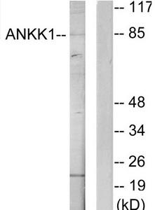 Western blot analysis of extracts from HeLa cells, using ANKK1 antibody.The lane on the right is treated with the synthesized peptide.