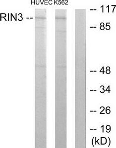 Western blot analysis of extracts from HUVEC cells and K562 cells, using RIN3 antibody.The lane on the right is treated with the synthesized peptide.