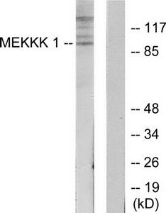 Western blot analysis of extracts from HepG2 cells, using MEKKK 1 antibody.The lane on the right is treated with the synthesized peptide.