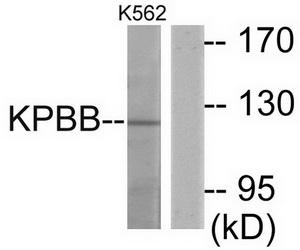 WB using the antibody against H3K4me1 diluted 1:750 in TBS-Tween containing 5% skimmed milk. The position of the protein of interest is indicated on the right; the marker (in kDa) is shown on the left.