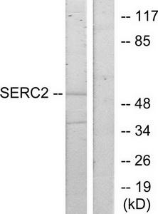 Western blot analysis of extracts from HeLa cells, using SERC2 antibody.The lane on the right is treated with the synthesized peptide.