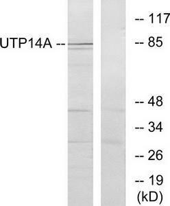 Western blot analysis of extracts from HeLa cells, using UTP14A antibody.The lane on the right is treated with the synthesized peptide.