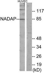 Western blot analysis of extracts from HUVEC cells, using NADAP antibody.The lane on the right is treated with the synthesized peptide.